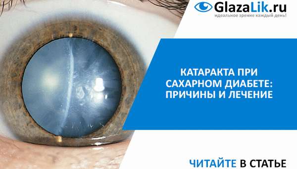 лечение катаракты при диабете